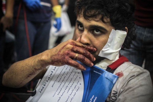 Rabia katliamının acı fotoğrafları 26