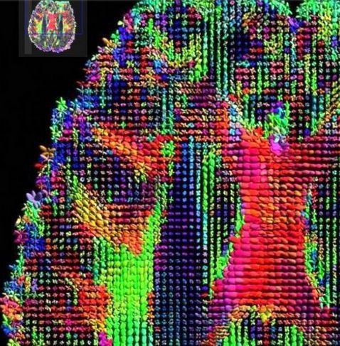 İşte insan beyninin en ayrıntılı görüntüleri 12