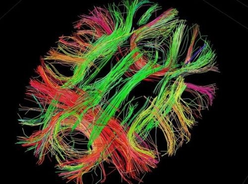 İşte insan beyninin en ayrıntılı görüntüleri 13