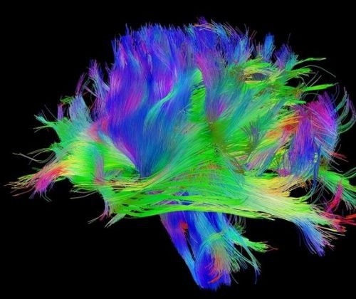 İşte insan beyninin en ayrıntılı görüntüleri 14
