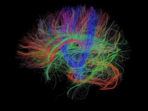İşte insan beyninin en ayrıntılı görüntüleri 15