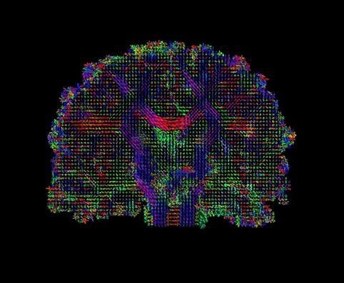 İşte insan beyninin en ayrıntılı görüntüleri 18