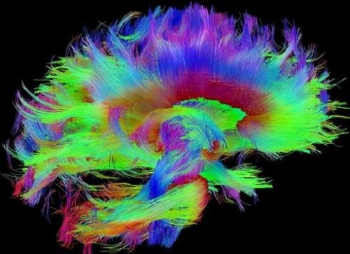 İşte insan beyninin en ayrıntılı görüntüleri 23
