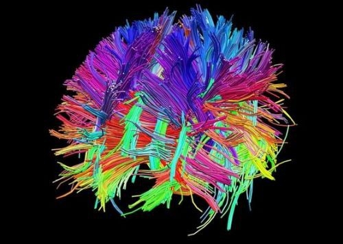 İşte insan beyninin en ayrıntılı görüntüleri 24
