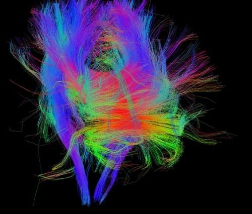 İşte insan beyninin en ayrıntılı görüntüleri 25