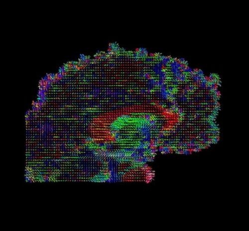 İşte insan beyninin en ayrıntılı görüntüleri 28