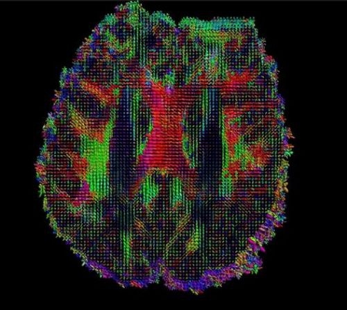 İşte insan beyninin en ayrıntılı görüntüleri 29