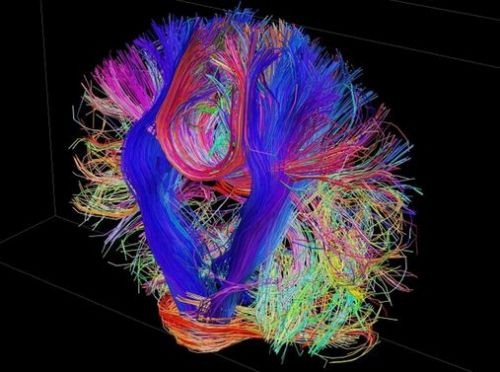 İşte insan beyninin en ayrıntılı görüntüleri 3