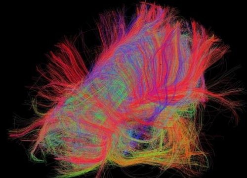 İşte insan beyninin en ayrıntılı görüntüleri 30