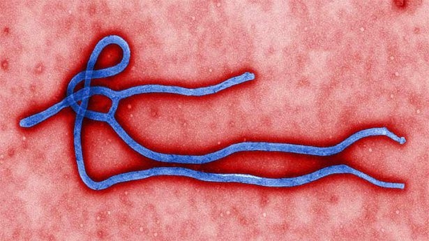 Ebola virüsü hakkın da bilinmeyenler 12