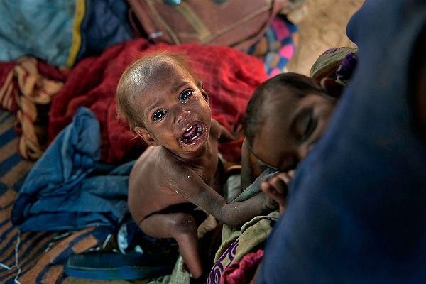 Şükür gerektiren kareler; Yoksulluk 6