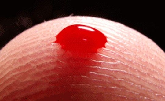 Vücudunuz hastalığınızı ele veriyor 22