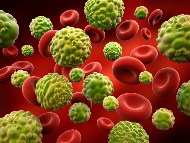 Erkeklerde kanser belirtisi! 29