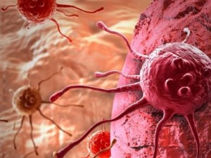 Erkeklerde kanser belirtisi!