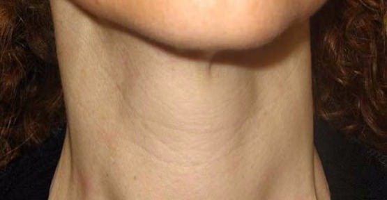 Saç dökülmesi, kilo artışı ve halsizlik varsa… 3