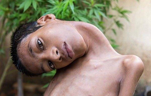 Bu halinden eser kalmadı 1