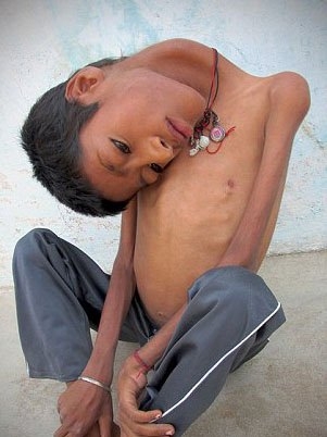 Bu halinden eser kalmadı 11