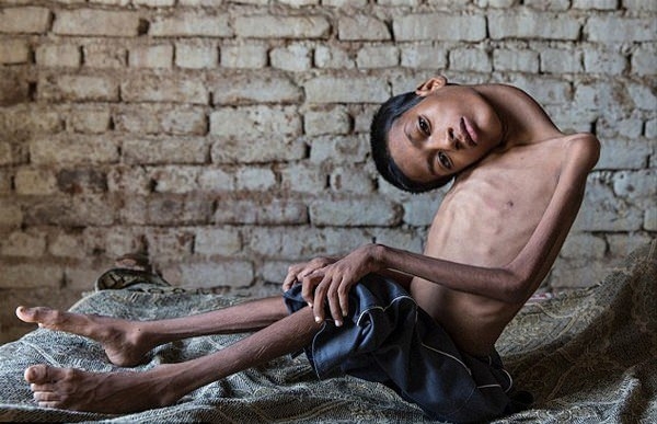 Bu halinden eser kalmadı 3