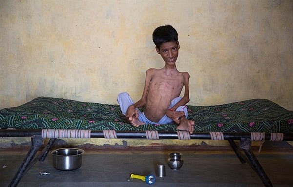 Bu halinden eser kalmadı 6