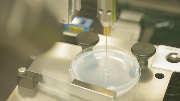 Türk doktorlar bir ilki başardı 1