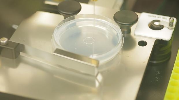 Türk doktorlar bir ilki başardı 3