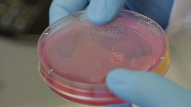 Türk doktorlar bir ilki başardı 5