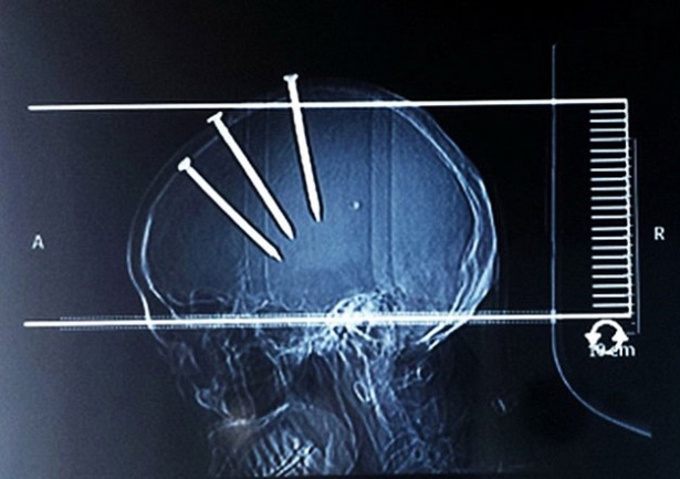 Tarihe kazınan mucizevi kurtuluşlar 15