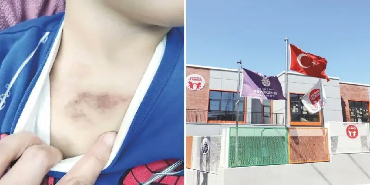 İBB Kreşlerinde Neler Oluyor? “Kreş Değil Epstein Adası” Tepkisi