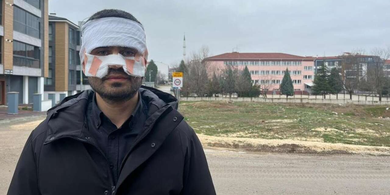 Öğretmen öğretmeni yaktı - Yüzüne sıcak çay fırlattı!