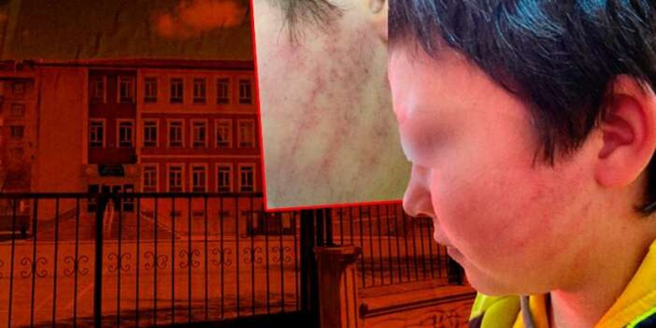 Okulda şiddet iddiası: Veliler sınıfa girip 8 yaşındaki çocuğu darp etti