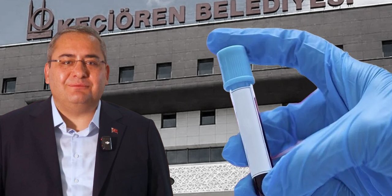 Belediyede Uyuşturucu Testi: 213 Personelin 171'inde Sonuç Pozitif Çıktı