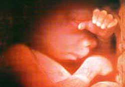 İngiltere'de 4 bin kadın tuvalet ve asansörde doğum yapmış