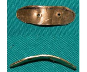 Göz kapağına 24 ayar altın