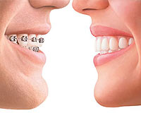 Altın fiyatları yükselince hastalar diş tellerini satmaya başladı
