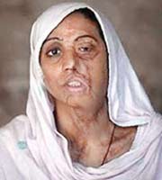 Gözleri Asitle Kör Edilecek