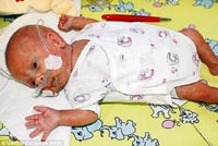 'En küçük erkek bebek' hayata tutunmayı başardı