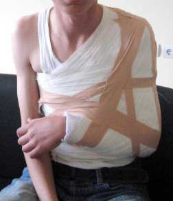 Kadın müdür öğrencinin kolunu kırdı