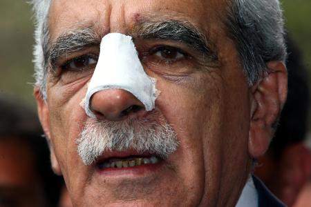 Ahmet Türk yumruklu saldırı için ne dedi?