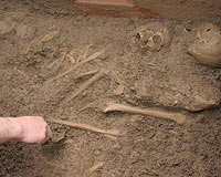 4 bin yıl önce beyin ameliyatı yapılmış