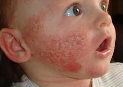 Çin malı koltuk bu hale getirdi!