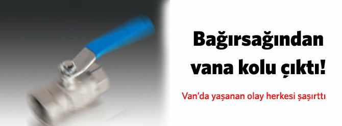Bağırsağından vana kolu çıktı!