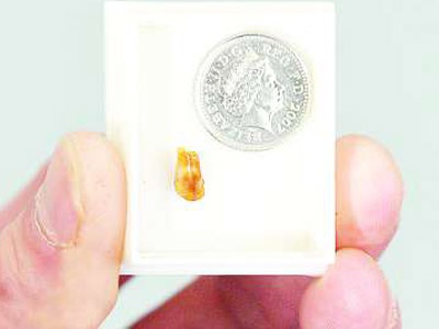 Dişini kulağından çıkarttılar