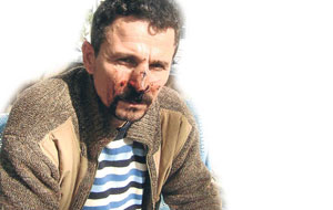 Karakolda dayak yedi 155i aradı