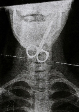 Makas boğazında kaldı!