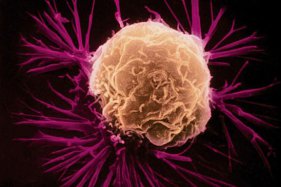 Hazır gıdada kanser tehlikesi var