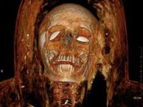 Kuyunun Dibinde 30 Mumya