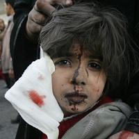 ABD'nin kınamadığı saldırı