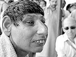 Fare insanların büyük dramı