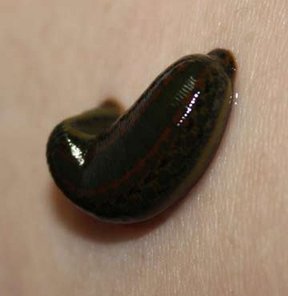 Dünya Türkiye'nin sülüğüne muhtaç!