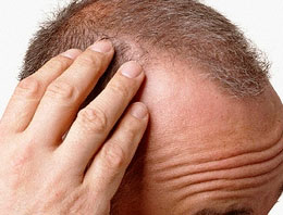 Saç çıkaran spreye toplatma kararı